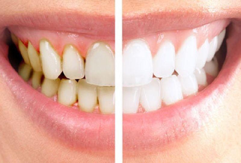 DENTI1.jpeg